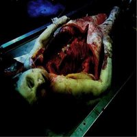 Medic Vomiting Pus - First Demo (2008)