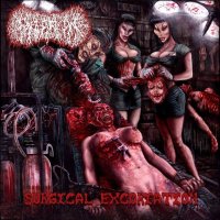 Paediatrician - Surgical Excoriation (2014)