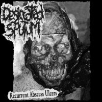 Desiccated Sputum - Recurrent Abscess Ulcers (2013)