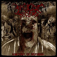 Regicide Decease - Anatomy of Sickness (2011)