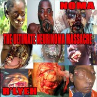 R\'lyeh & NOMA - The Ultimate Neurinoma Massacre (Split) (2013)