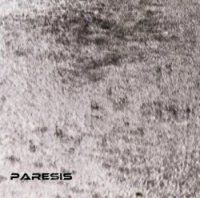 Paresis - That.Black.Form (2017)