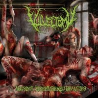 Vulvectomy - Abusing Dismembered Beauties (2013)