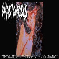 Anastomosis - Perforations Of The Esophagus And Stomach (EP) (2015)