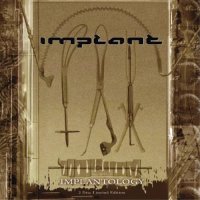 Implant - Implantology (2009)