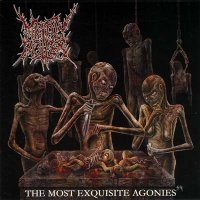 Mindly Rotten - The Most Exquisite Agonies (2005)  Lossless