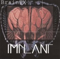 Implant - BrainFX (1997)