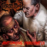 Clitorodectomía - Anatomical Inordinatio (2015)