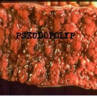 Pseudopolyp - Demo #1 (2013)