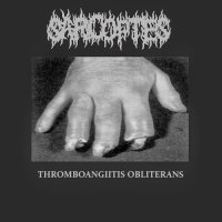 Sarcoptes - Thromboangiitis Obliterans (Demo) (2013)