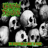 Chainsaw Dissection - The Dissection Is About To Begin (EP) (2015)